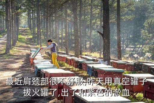 最近肩頸部很不舒服,昨天用真空罐子拔火罐了,出了和紫色的淤血