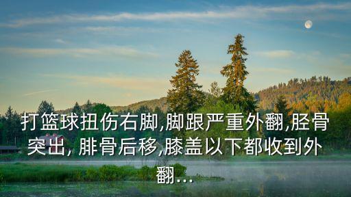 打籃球扭傷右腳,腳跟嚴(yán)重外翻,脛骨突出, 腓骨后移,膝蓋以下都收到外翻...