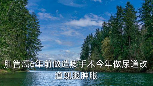 肛管癌6年前做造瘺手術(shù)今年做尿道改道現(xiàn)腿腫脹